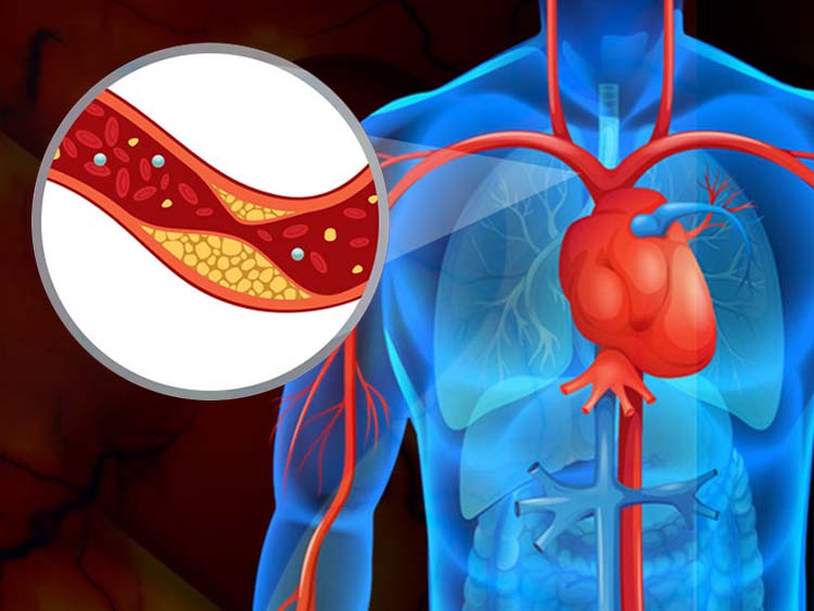 Sirds un hipertensija